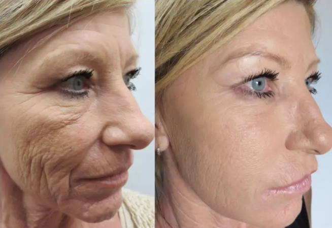 EBM 未開封Native Beauty Harmonia2点セット Restoration Serum 5ml sample~ NES028/S – Natural Elements